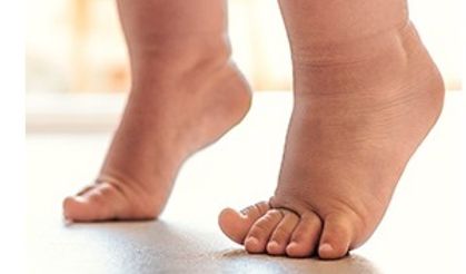 ÇOCUKLARDA BU YÜRÜYÜŞ ŞEKLİNE DİKKAT!